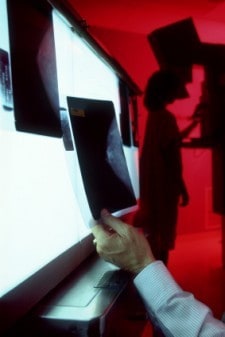 Mammogram